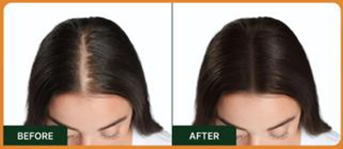 The Benefits of Batana Oil for Hair Growth & Scalp Health